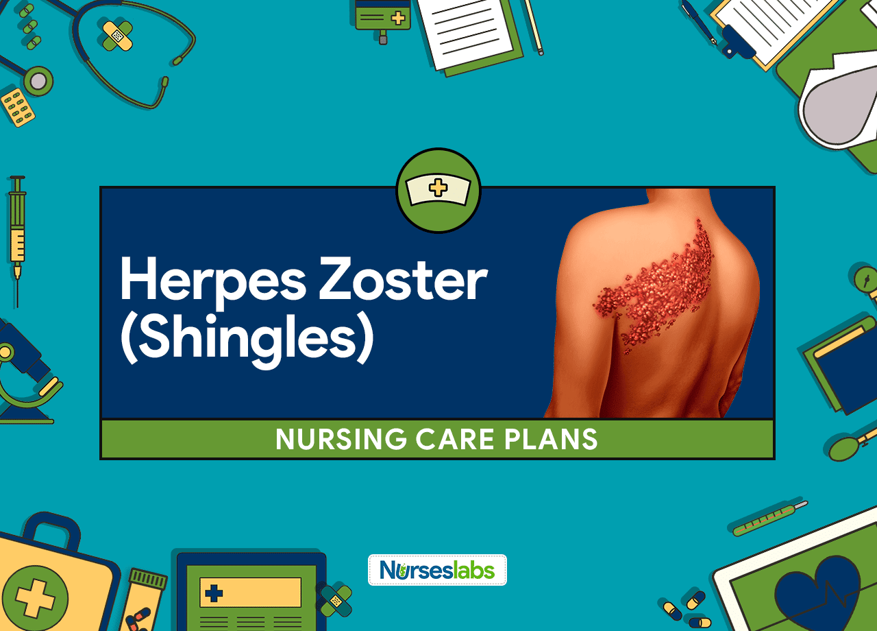 4 Herpes Zoster (Shingles) Nursing Care Plans