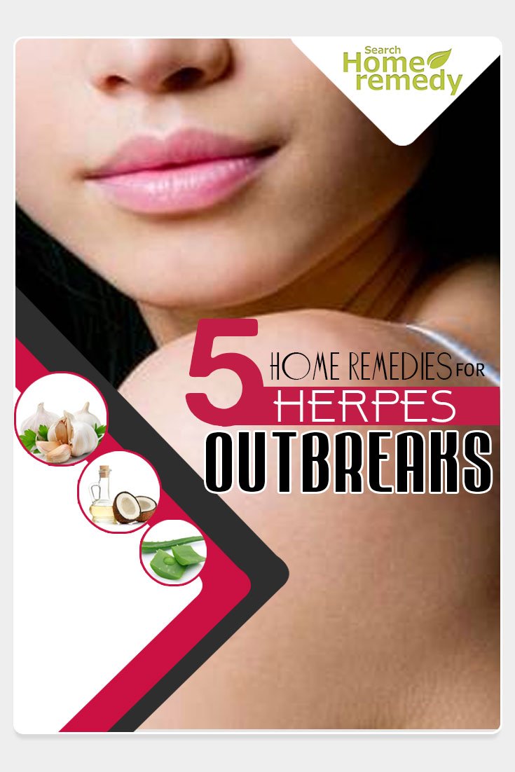 5 Home Remedies For Herpes Outbreaks