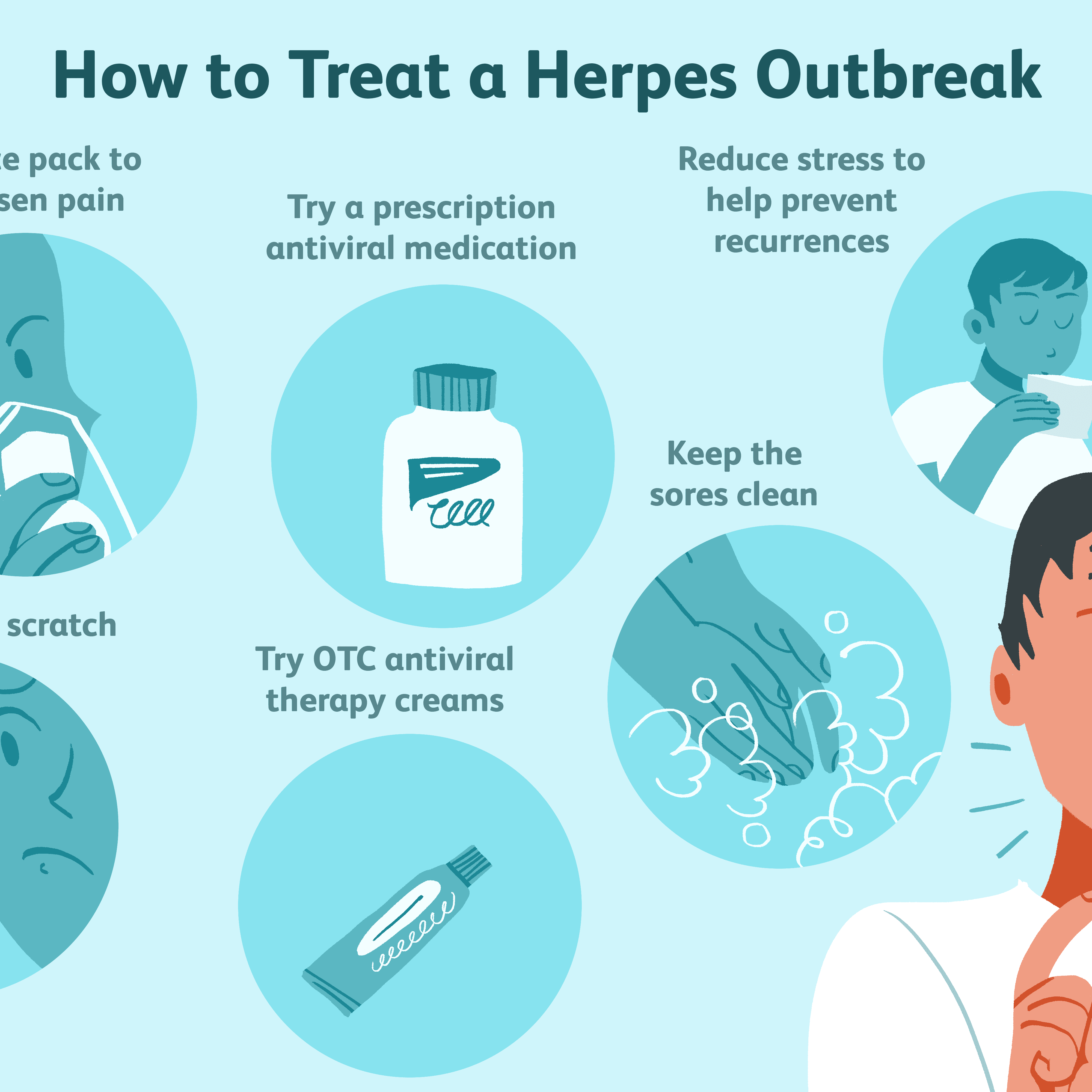 Alternative Medicine For Herpes Simplex Virus