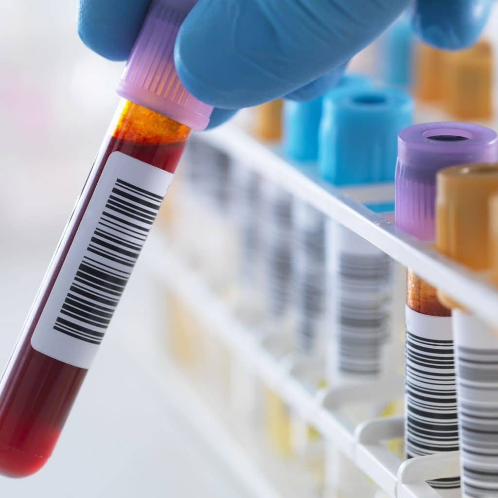 Are Blood Test Accurate For Herpes