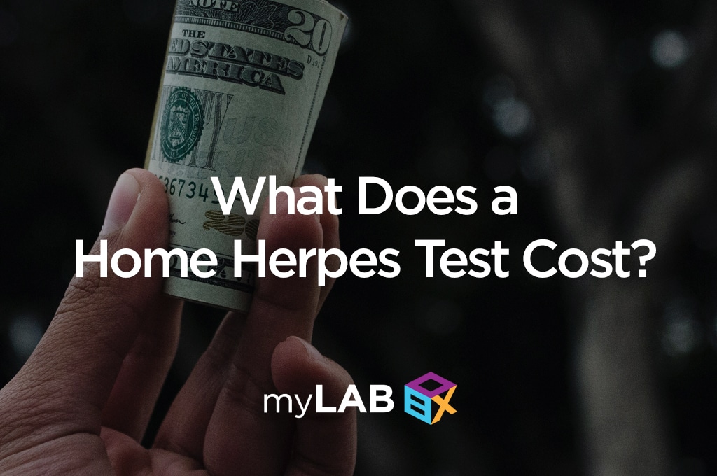 At Home Herpes Testing Cost