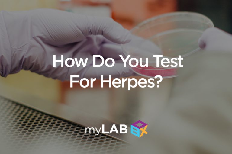 Can Men Be Tested For Herpes