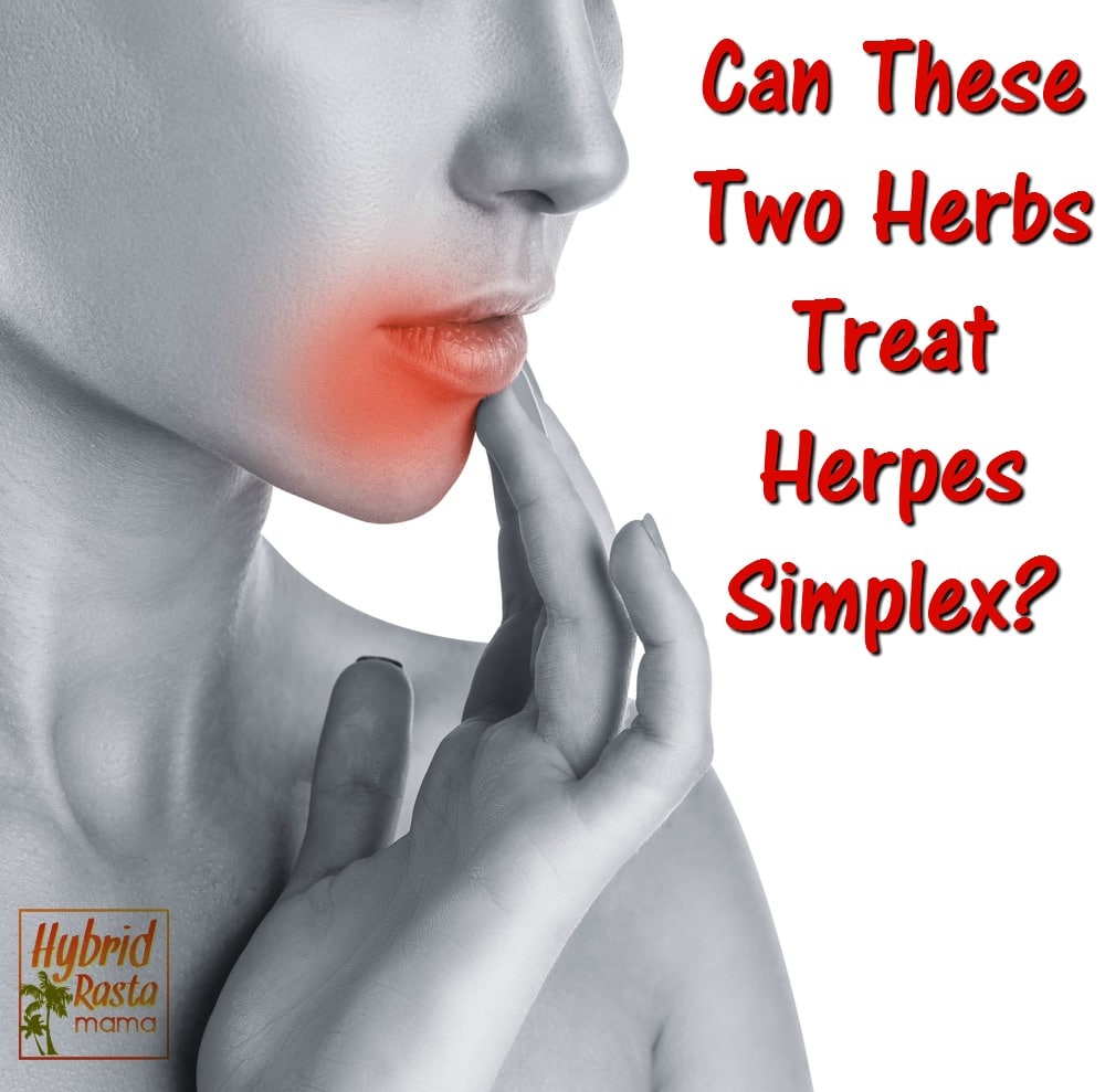 Can These Two Herbs Treat Herpes Simplex? by Hybrid Rasta Mama