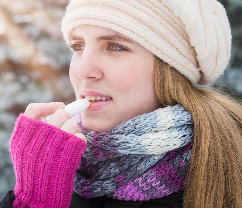 Cold sore: causes, stages, treatment