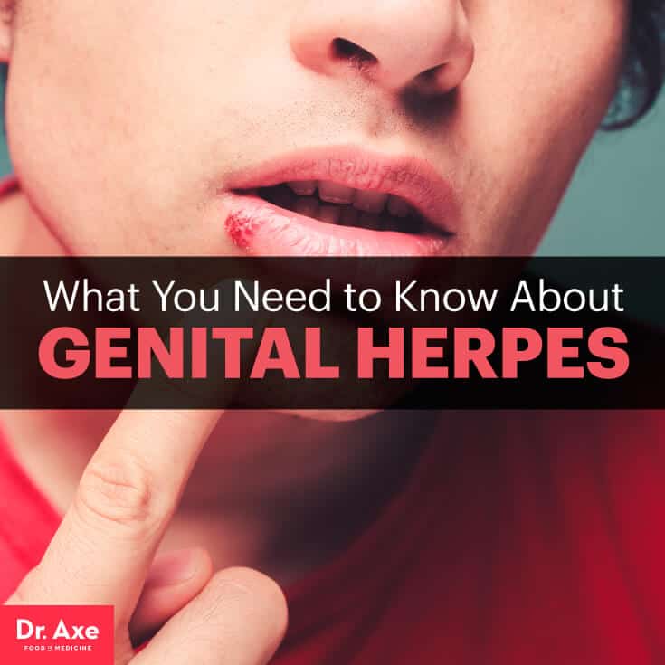 Do I Have Genital Herpes