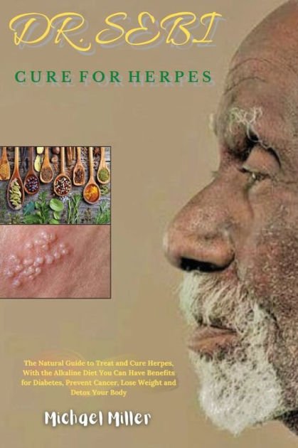 Dr. Sebi Cure for Herpes: The Natural Guide to Treat and ...