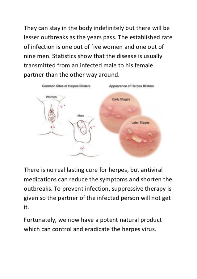 Effective herpes treatment