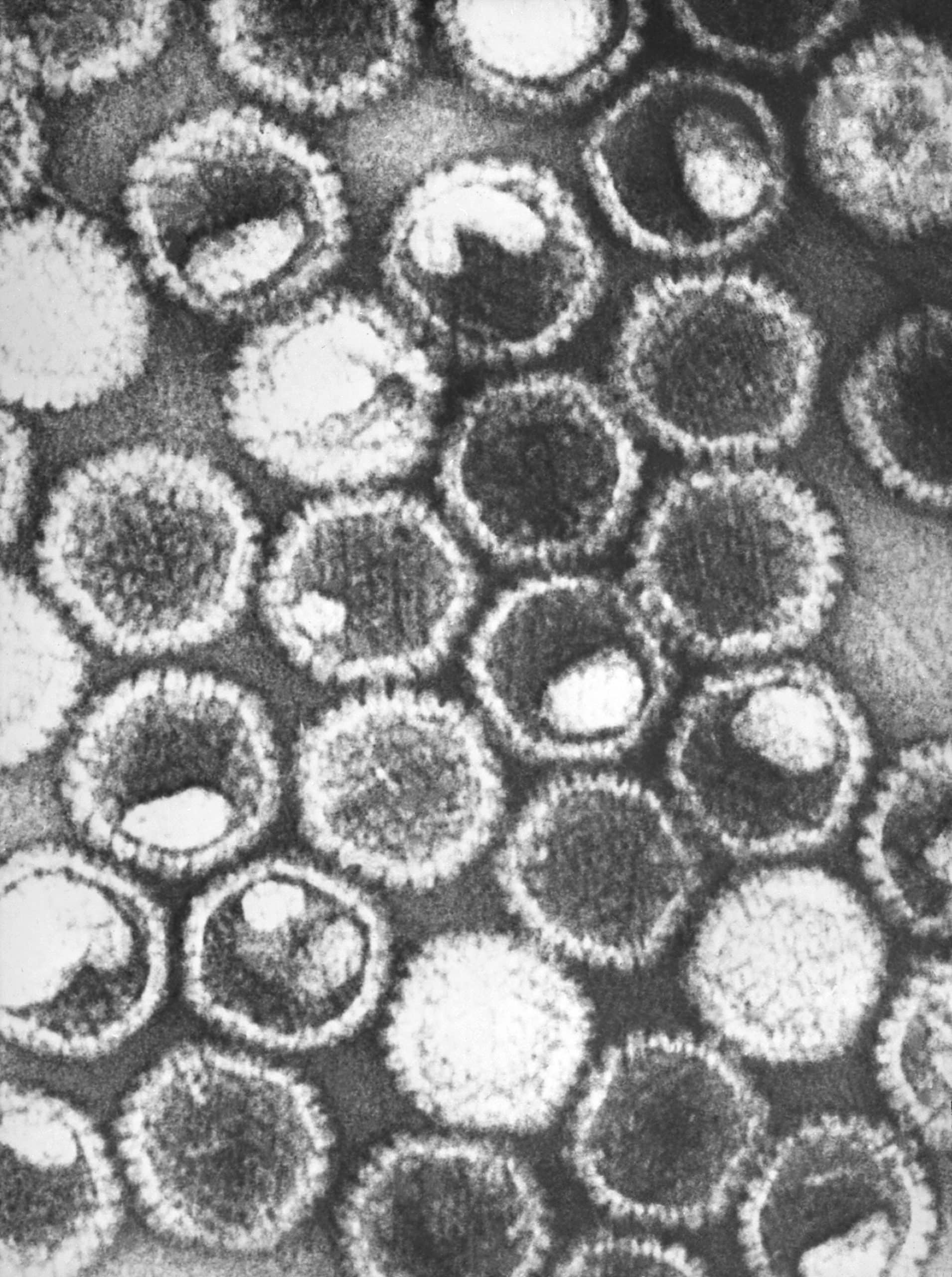 Electron micrograph of herpes simplex virus