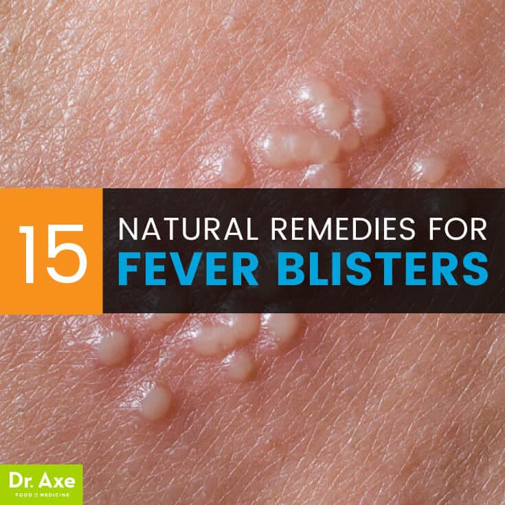 Fever Blister Causes + 15 Natural Remedies