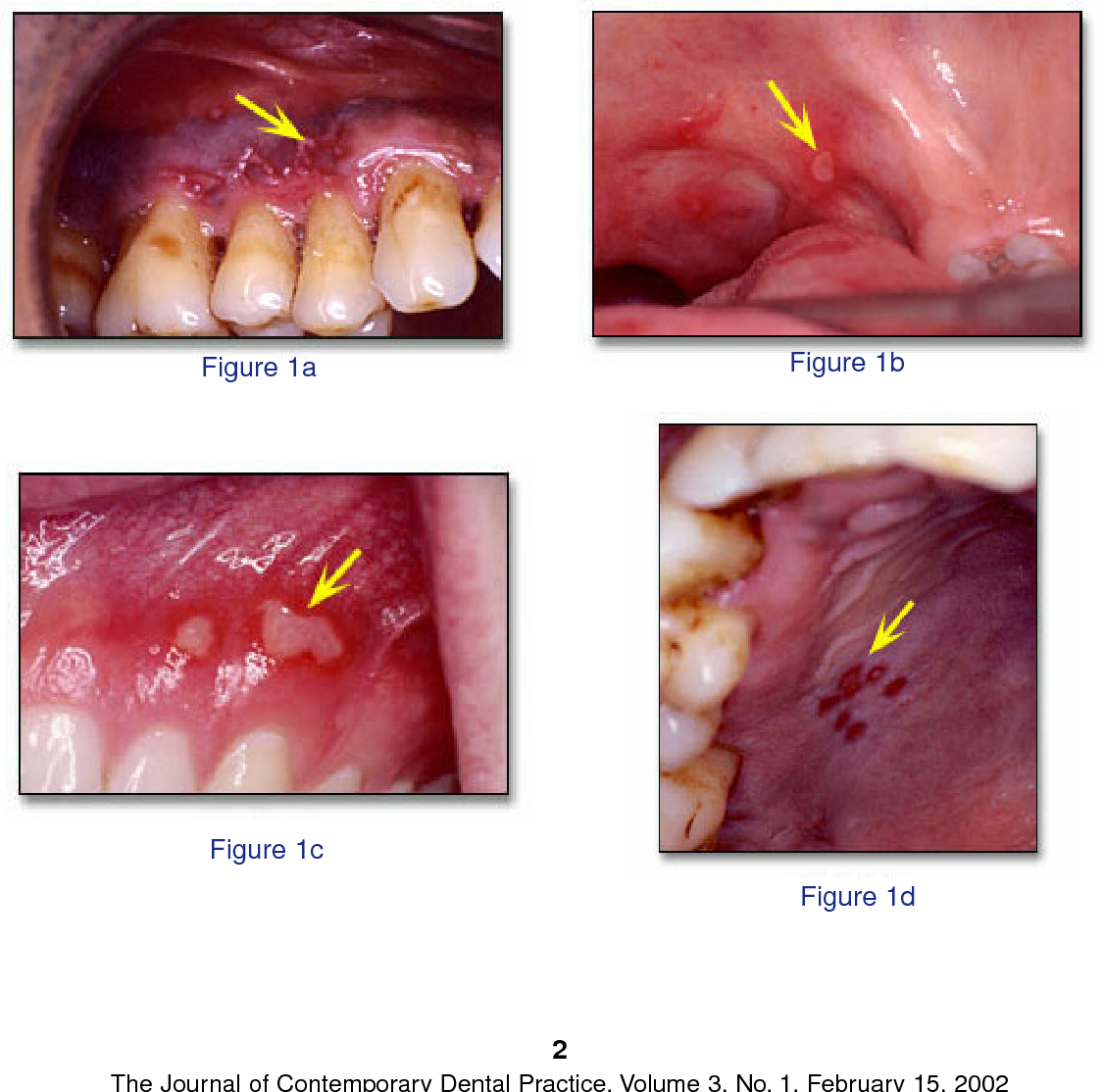 Figure 1 from Differential diagnosis: is it herpes or aphthous ...