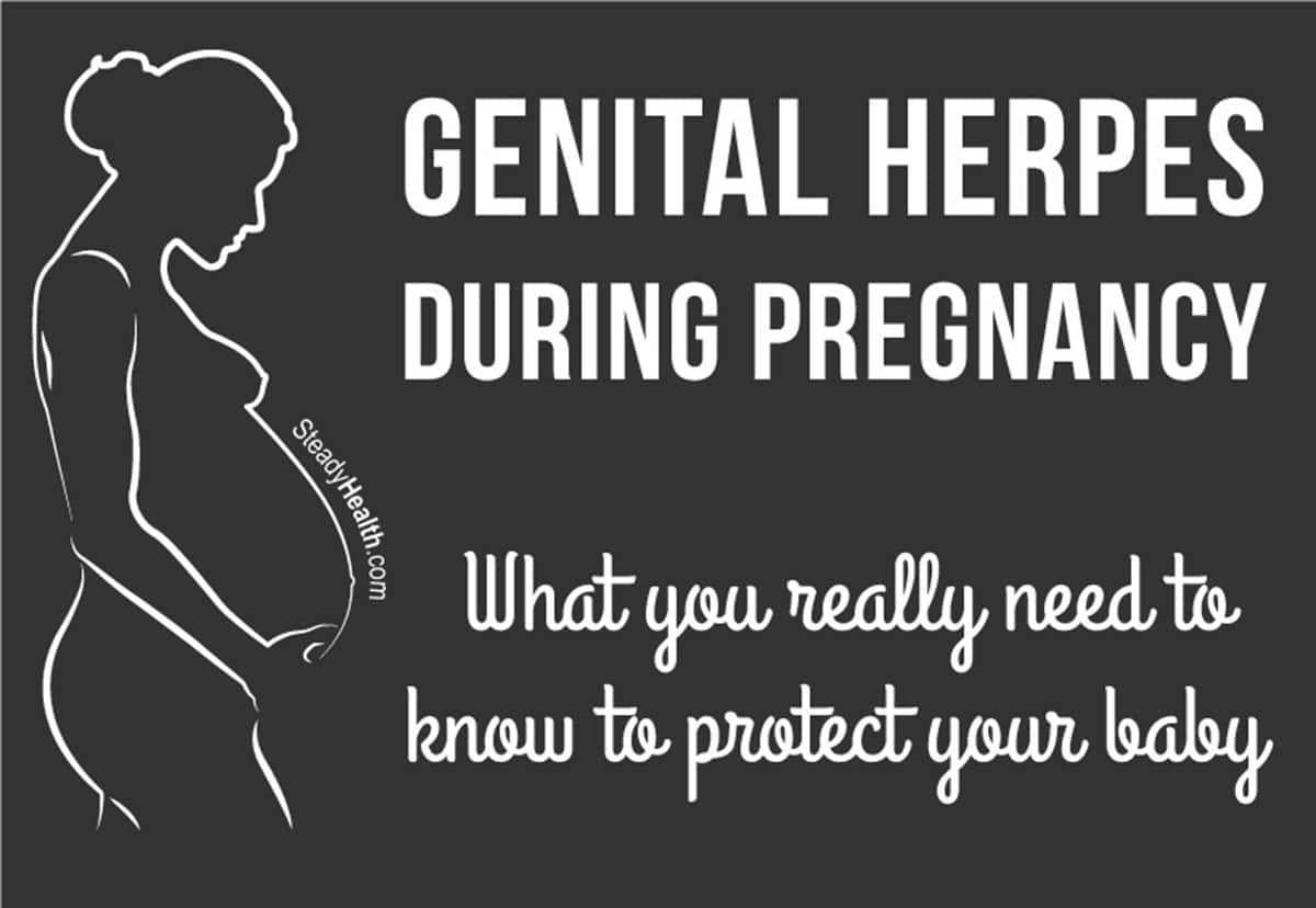 Genital Herpes During Pregnancy: What You Really Need To Know To ...