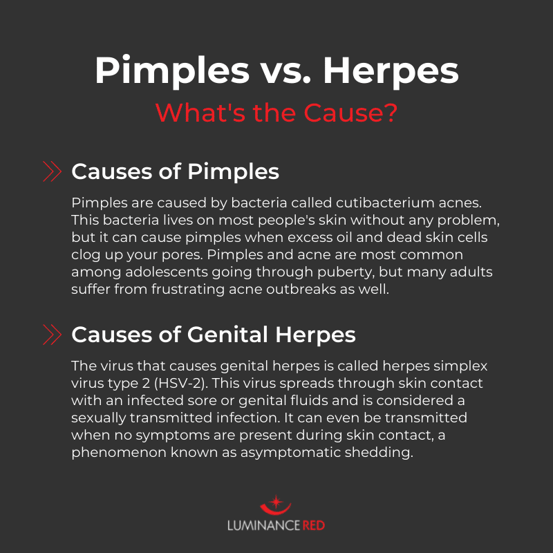 Genital Herpes or Pimples? How To Tell the Difference  Luminance Red
