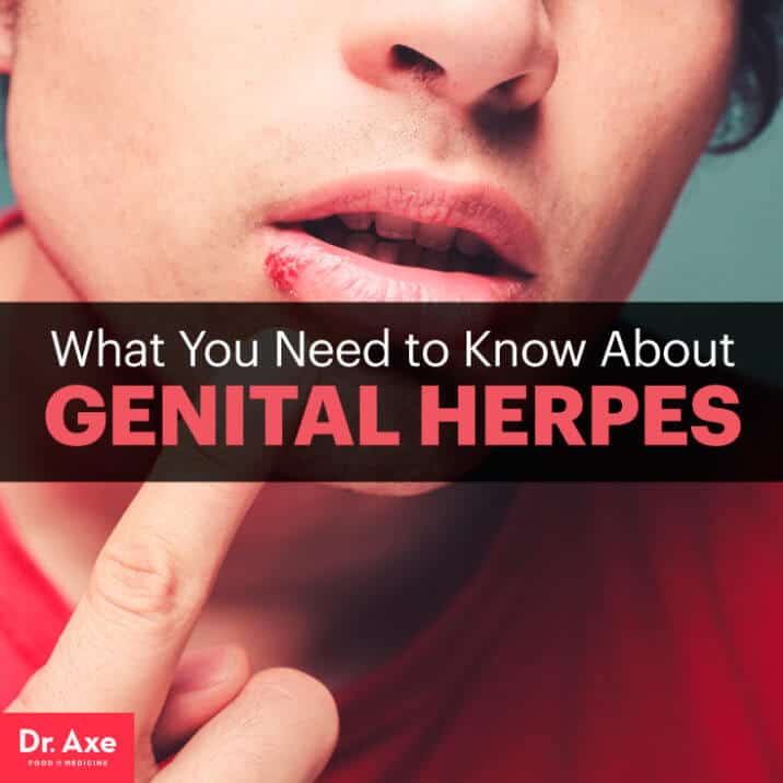 Genital Herpes Symptoms, Risk Factors &  Treatments