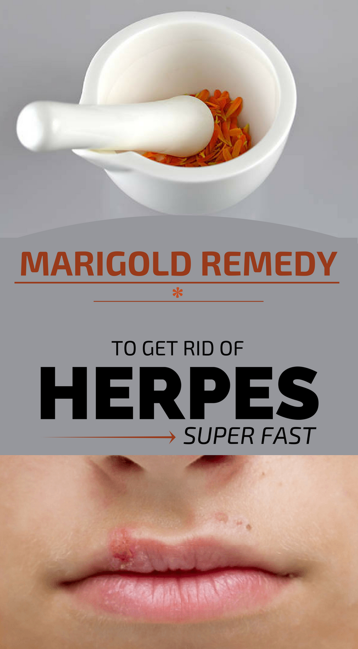 Get rid of herpes fast THAIPOLICEPLUS.COM
