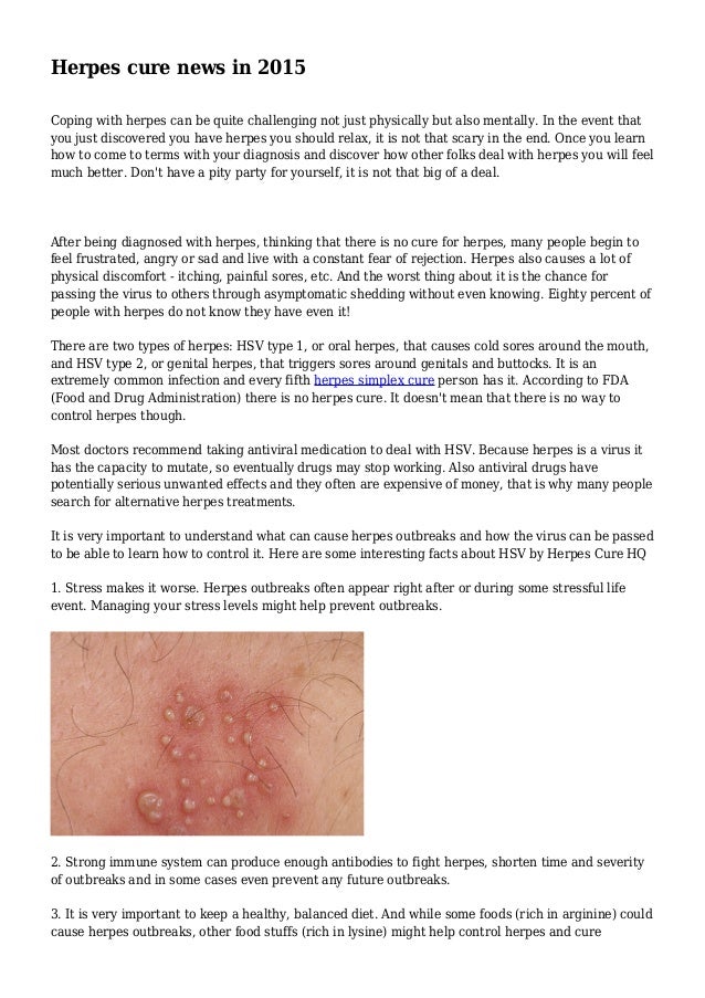 Herpes cure news in 2015