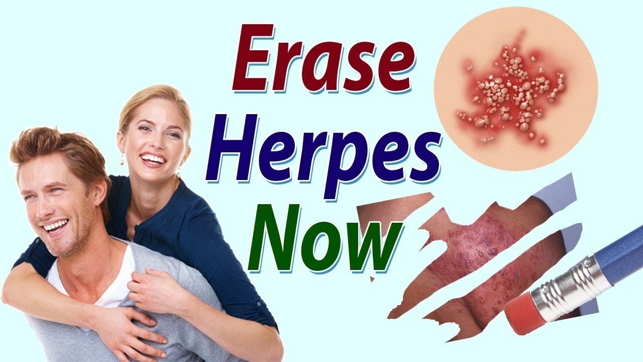 Herpes Eraser / Permanently Eliminate the Herpes Virus ...