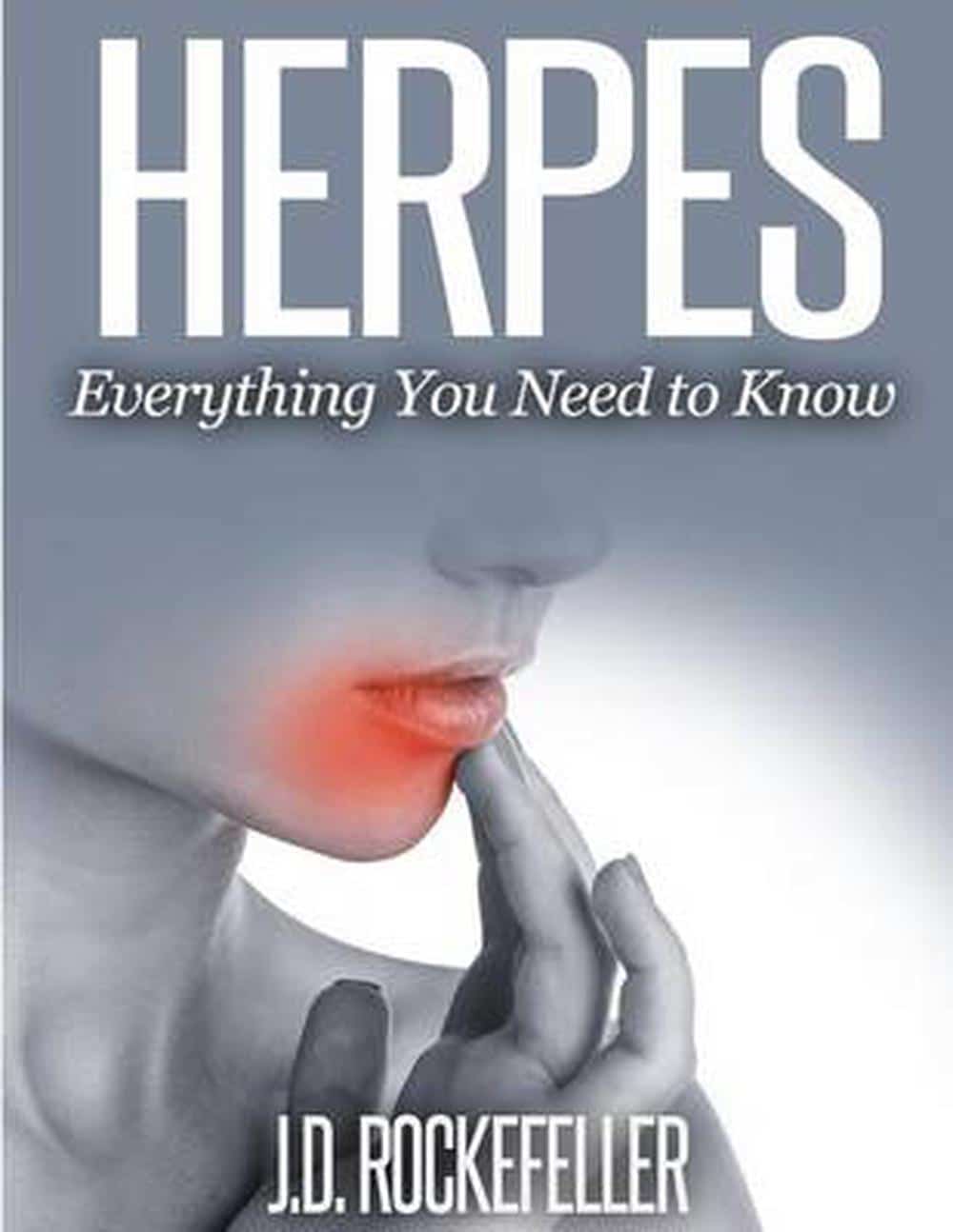 Herpes: Everything You Need to Know by J.D. Rockefeller (English ...