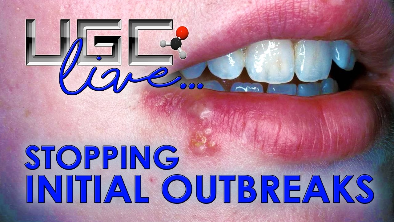 HERPES FLARE UPS / OUTBREAKS