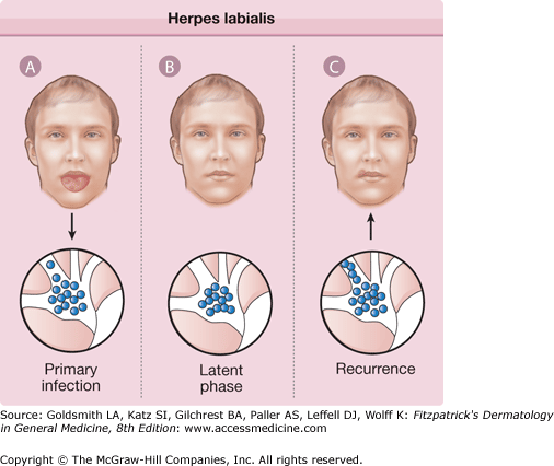 herpes labialis treatment guidelines
