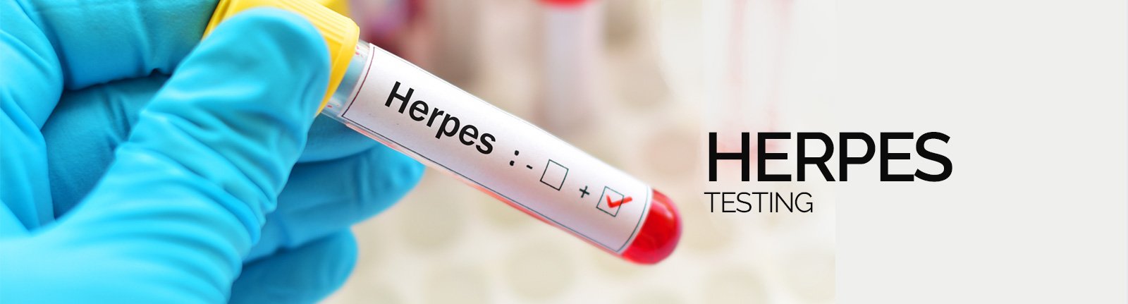 Herpes Test London