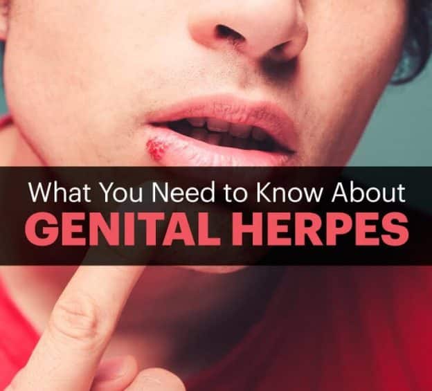 Herpes Treatment pills Archives