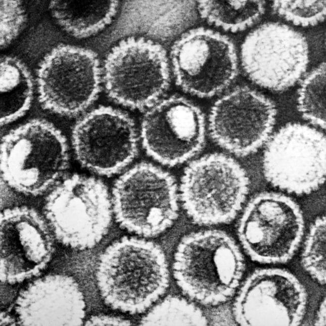 Herpes virus that attacks cancer is first of new viral therapies