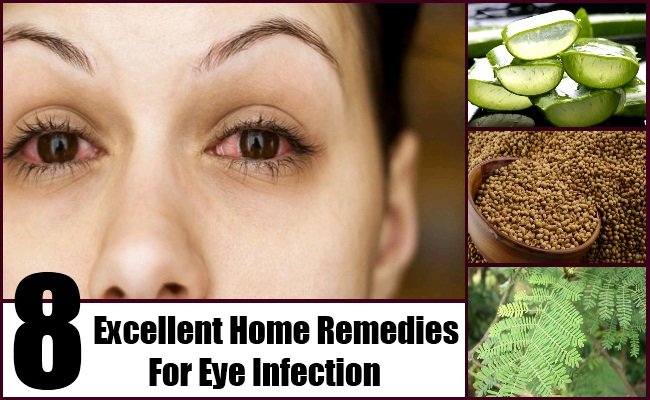 Home remedies for eye infections, herpes medication over the counter ...