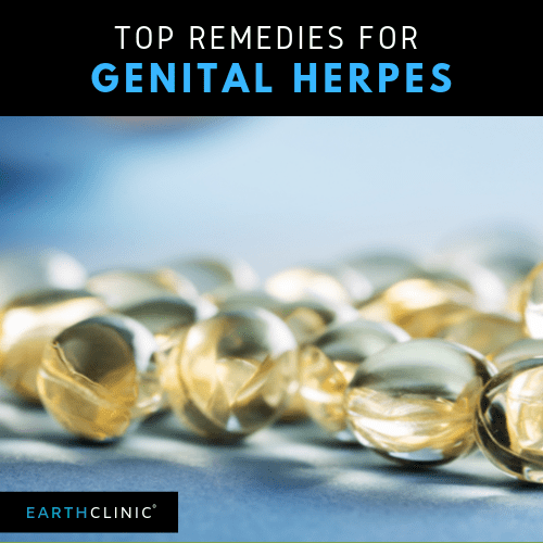 Home Remedies for Genital Herpes