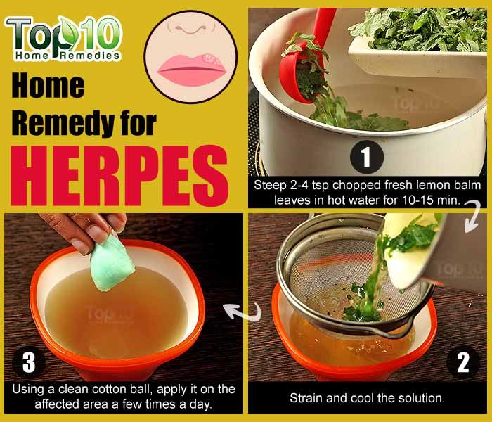 Home Remedies For Herpes Outbreaks