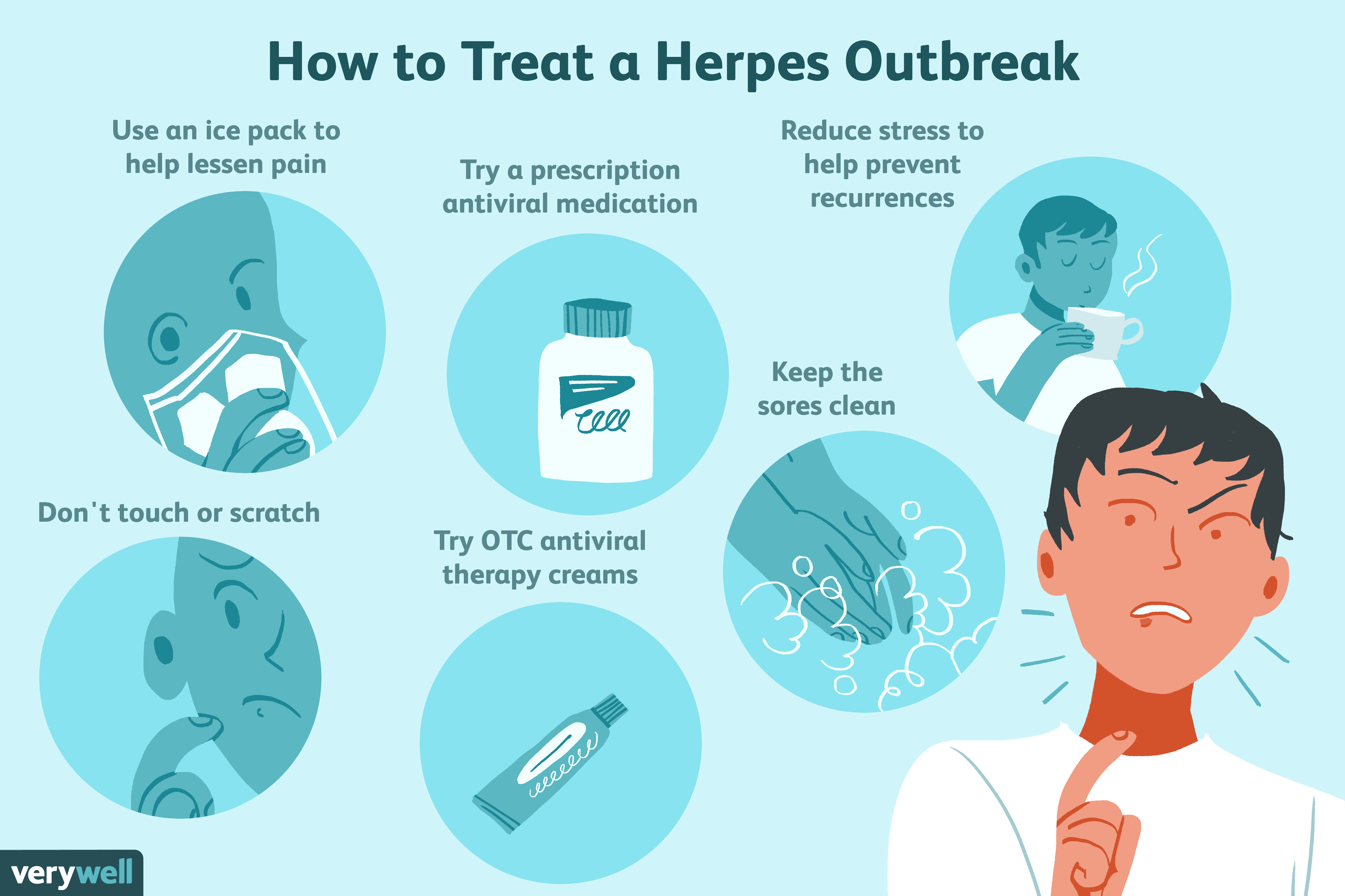 How Herpes Is Treated