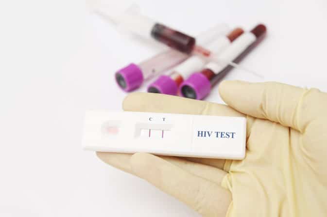 How Is an STD Test Performed?
