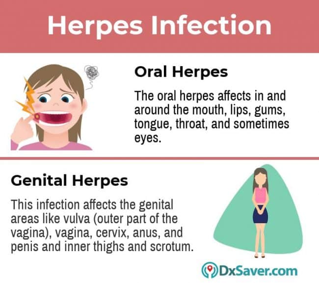 How much does Herpes Test Near Me Costs?