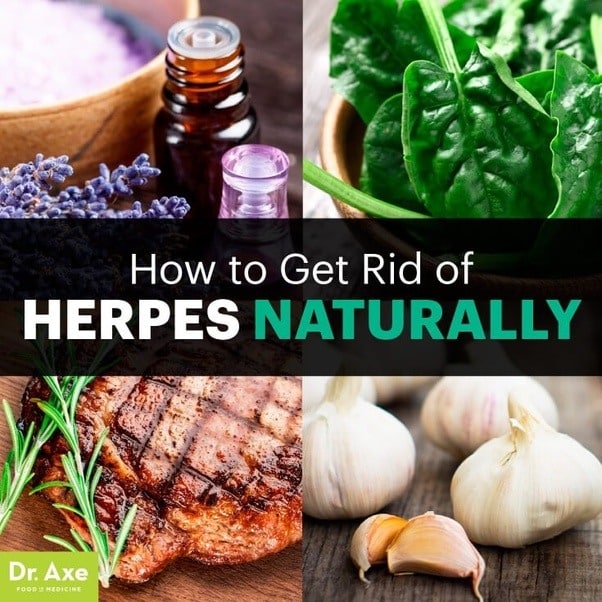 How to get rid of genital herpes