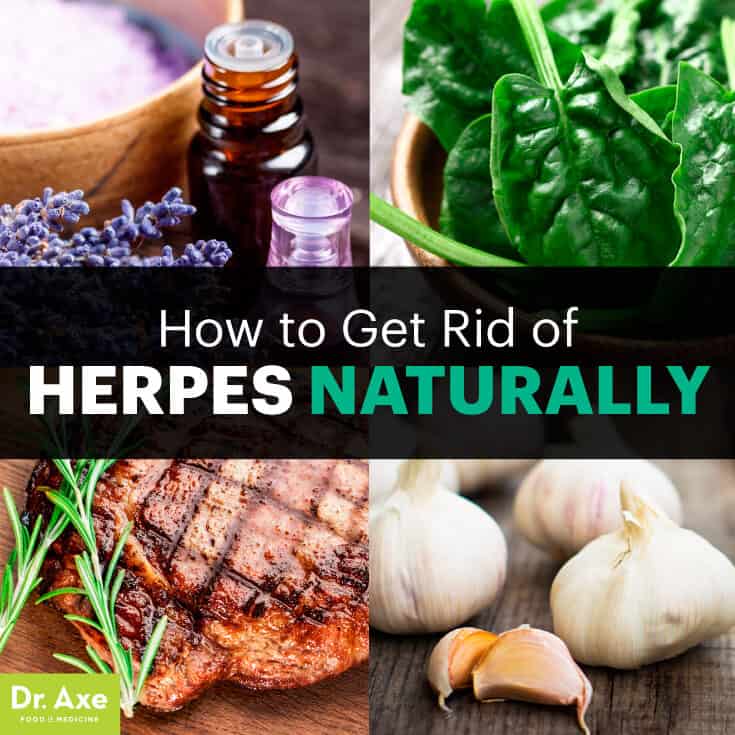 How to Get Rid of Herpes Symptoms Naturally