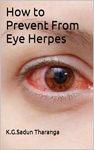How to Prevent From Eye Herpes (English Edition)