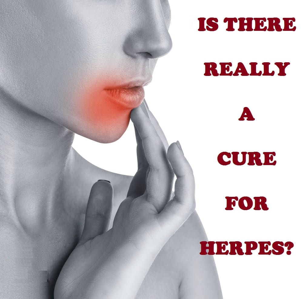 IS THERE REALLY A CURE FOR HERPES?