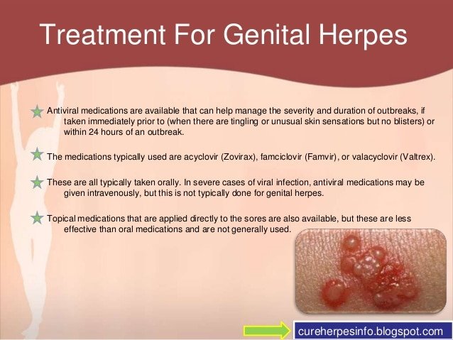 New Genital Herpes Medicine â Herpes Free Me