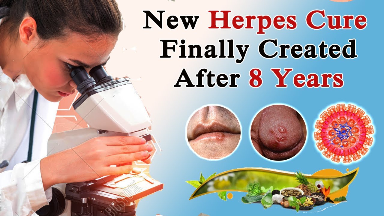 New Herpes Cure is Here