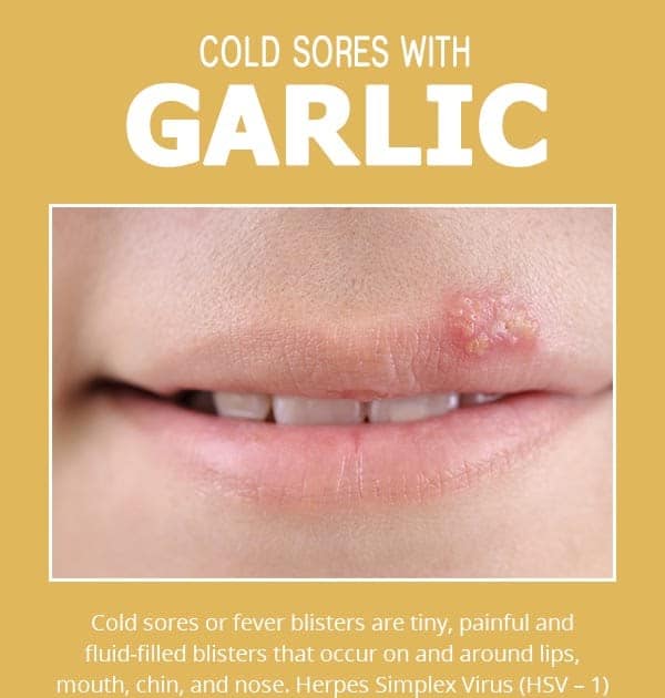 paalgardendesign: Can A Cold Sore Be Spread By Touch