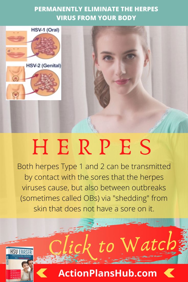 Pin on Remove herpes fast