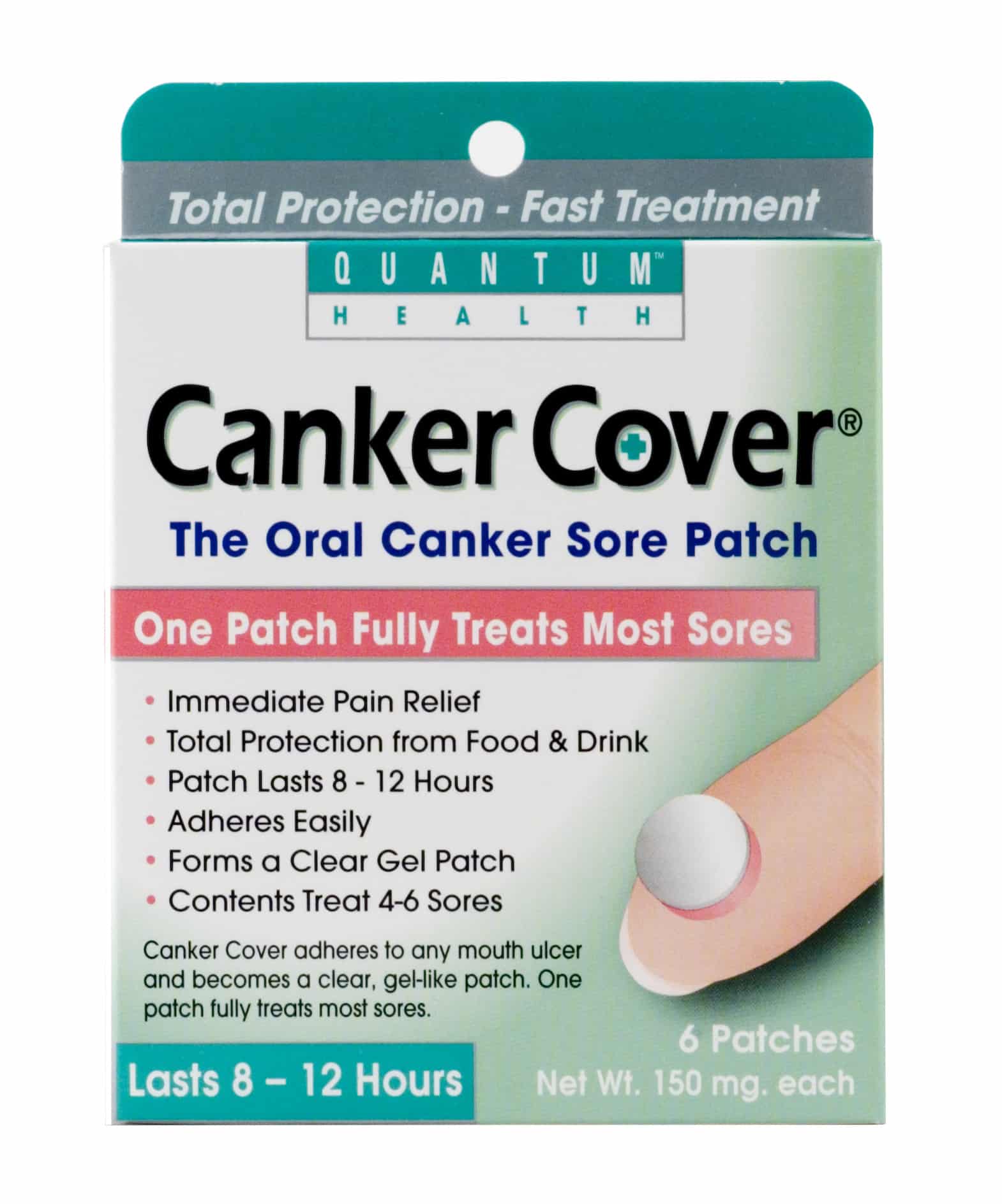 Study: Oral Patch Treatment Heals Canker Sores in One Day Compared to ...