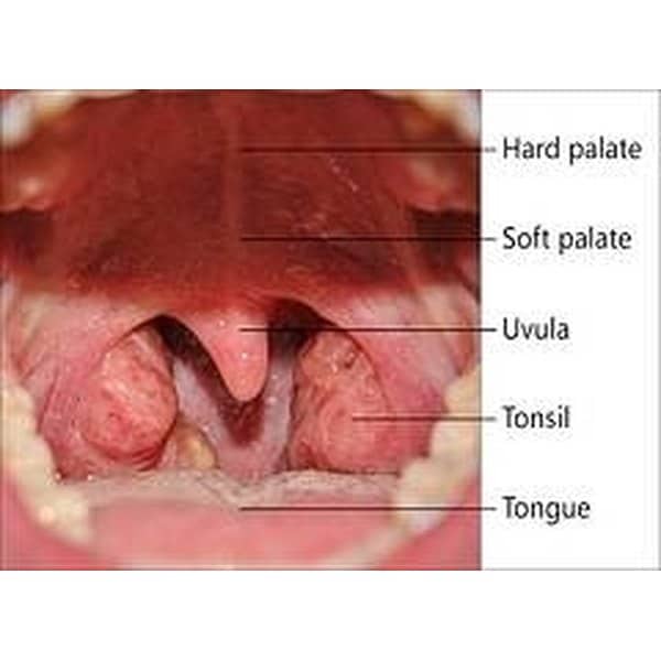 Symptoms of Throat Herpes