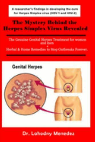 The Mystery Behind the Herpes Simplex Virus Revealed : The Genuine ...