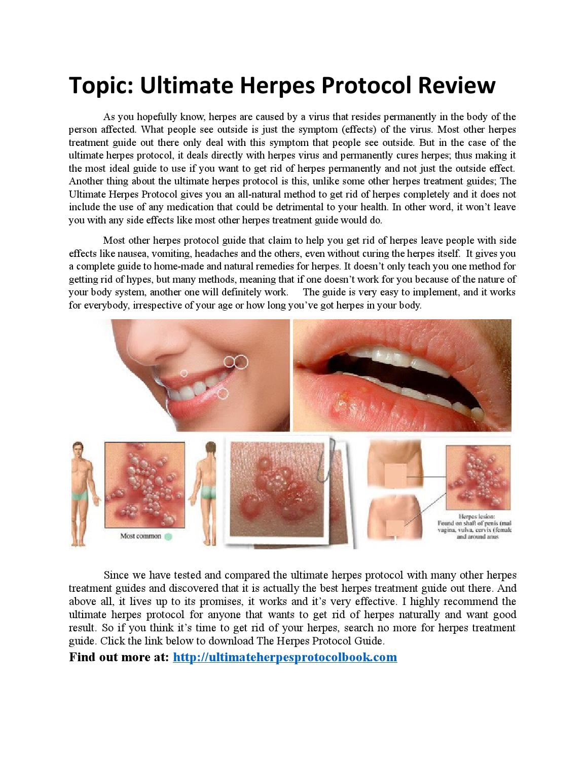 Ultimate Herpes protocol Review by jennifermaryy