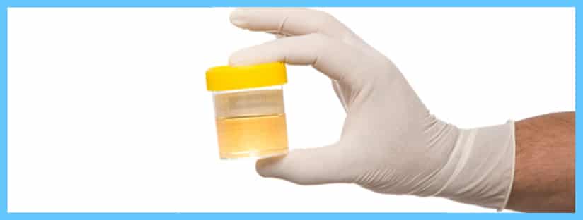 Urinalysis Testing â STD Testing