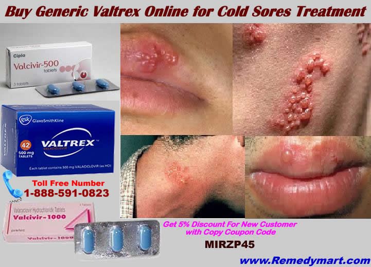 Valacyclovir Dosage For Fever Blister , Valtrex treat oral herpes