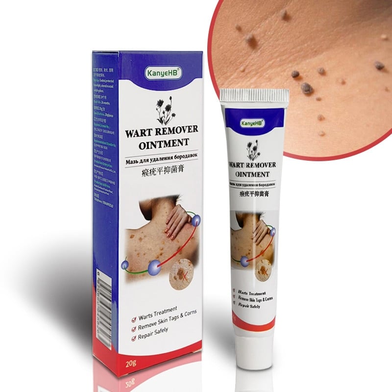 Wart Ointment Genital Herpes Skin Remover Antibacterial Treatment Cream ...