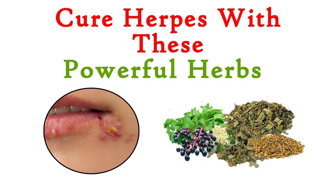 What is herpes.