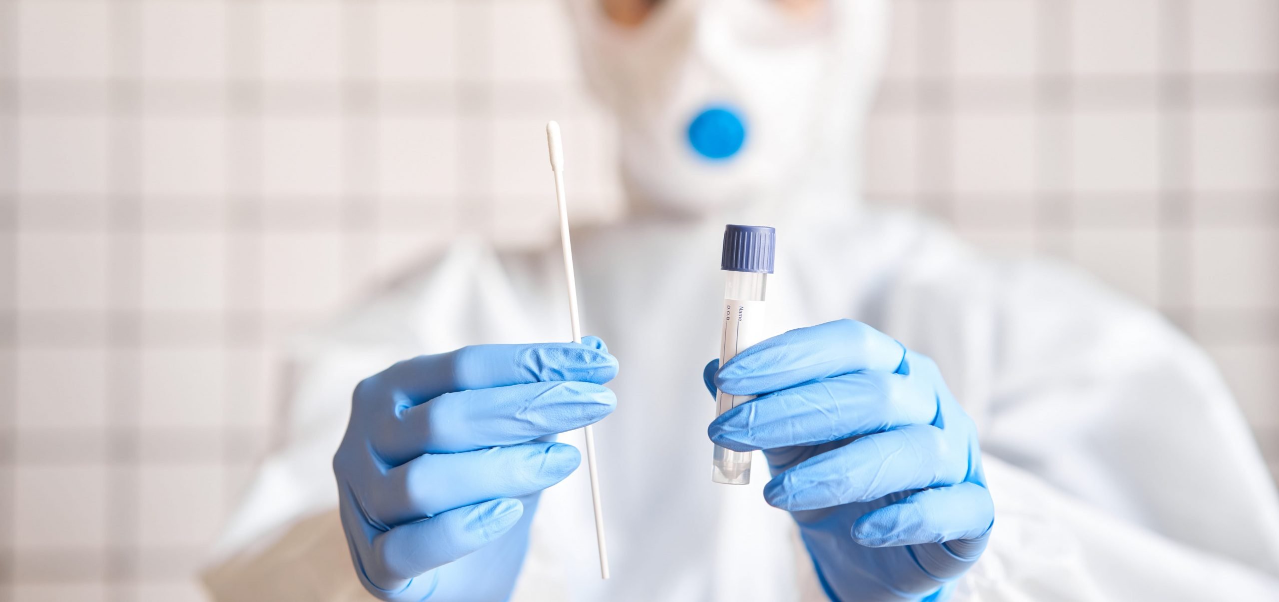 What Kind of Test Does the CDC Recommend for the Coronavirus Disease?