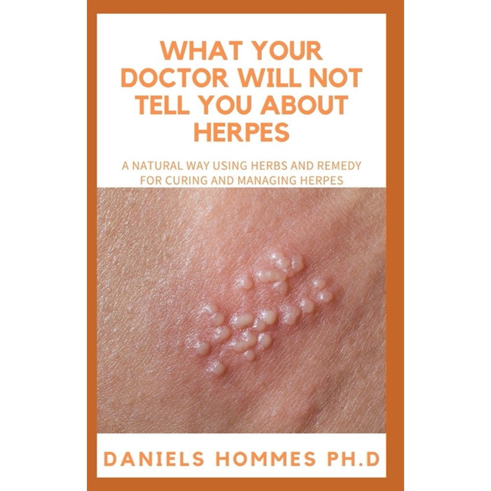What Your Doctor Will Not Tell You about Herpes : A Natural Easy herbal ...